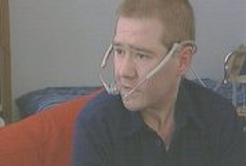 Billy Burke - Cystic fibrosis sufferer dies