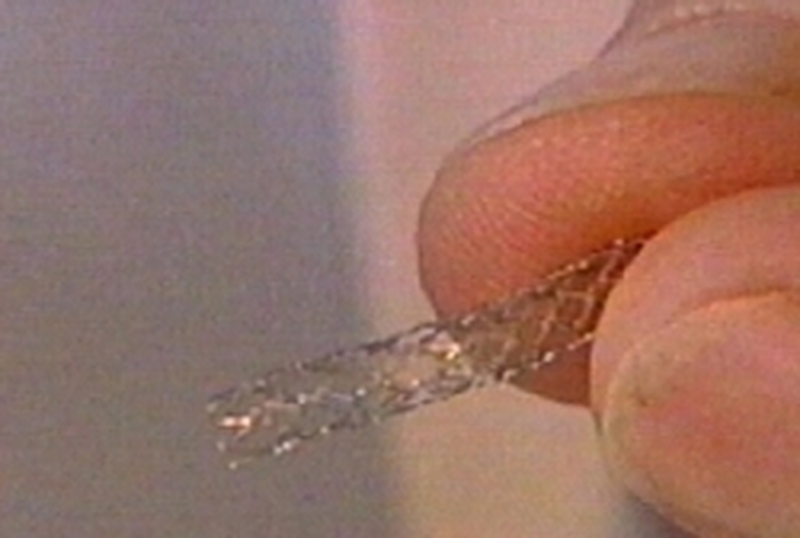 Stent - Boston Scientific recall