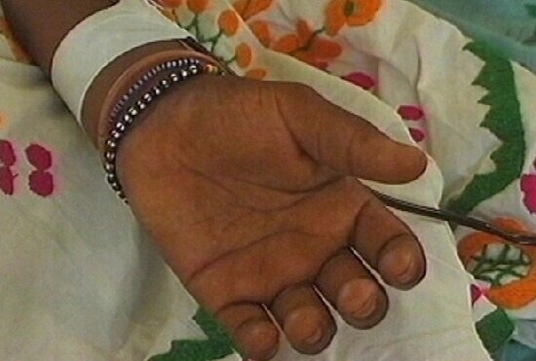 Aids - South Africa defends traditional cures