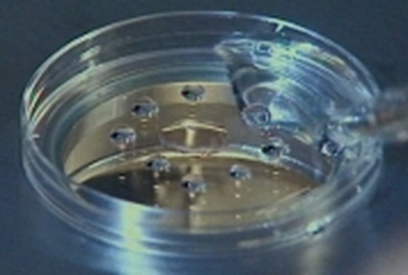 Stem cell research - US vote backs funding