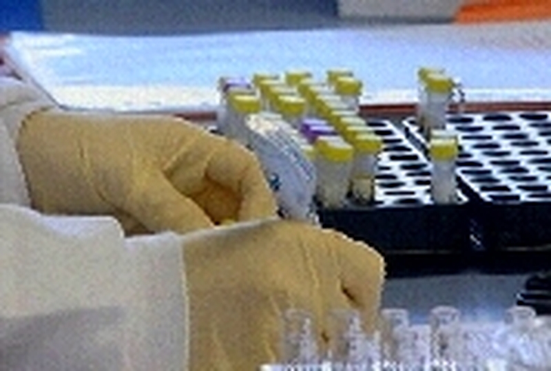 Cervical screening - Proposed programme