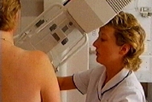 Breast cancer screening - Rise in uptake