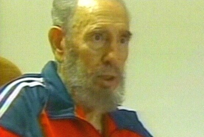 Fidel Castro - Had intestinal surgery in July 2006