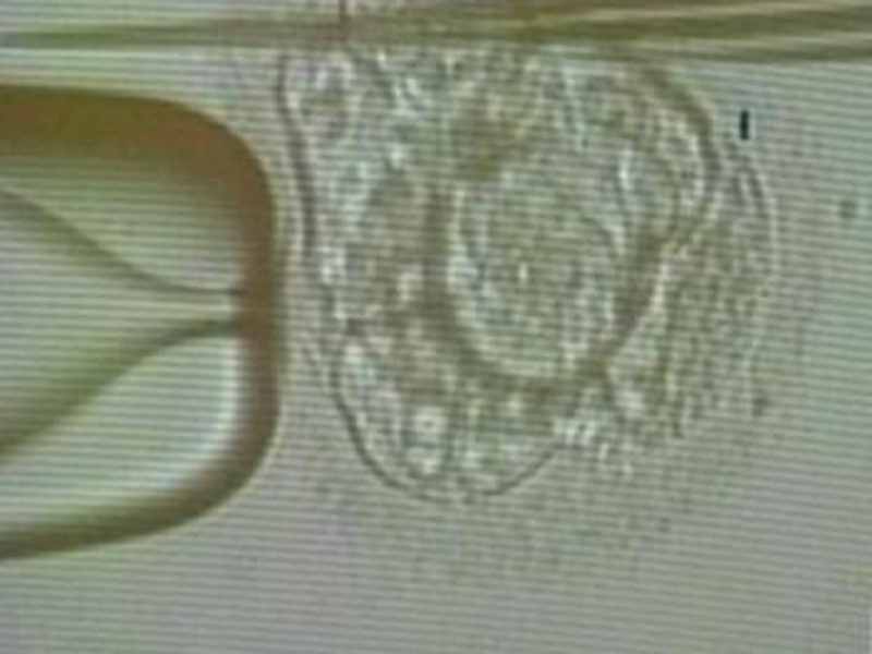 Embryo - Ethical questions over resarch