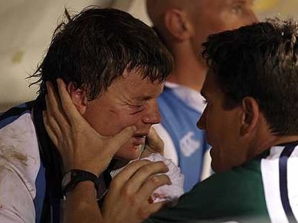 Brian O'Driscoll receiving treatment after he was punched in the face