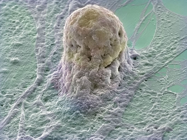 Stem cells - May have potential for various medical uses