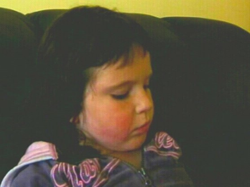 Millie Murray-McNamara - Was seriously injured in the fire