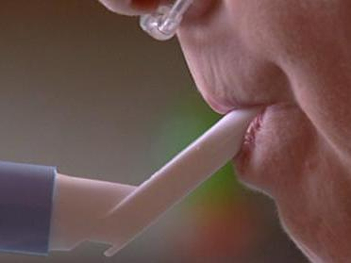 Cost of a newly-developed drug for Cystic Fibrosis, Kalydeco