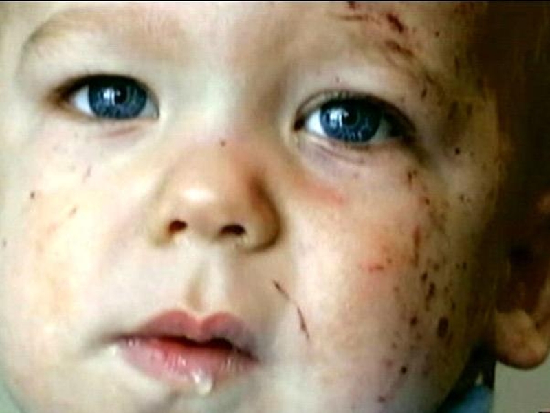 Kyson Stowell - Just a few scrapes and bruises