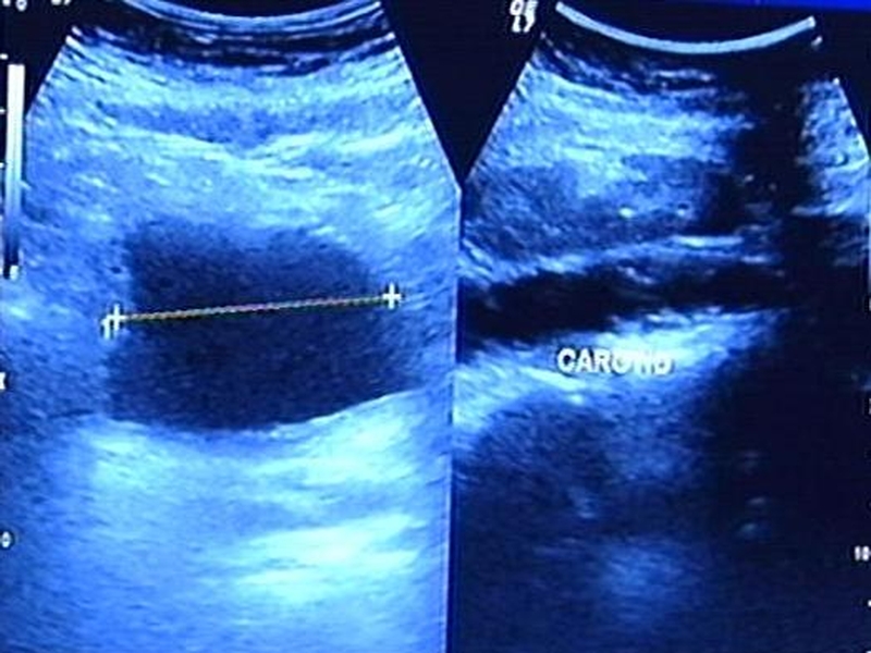 Image diagnostic - Improved tests for cancer