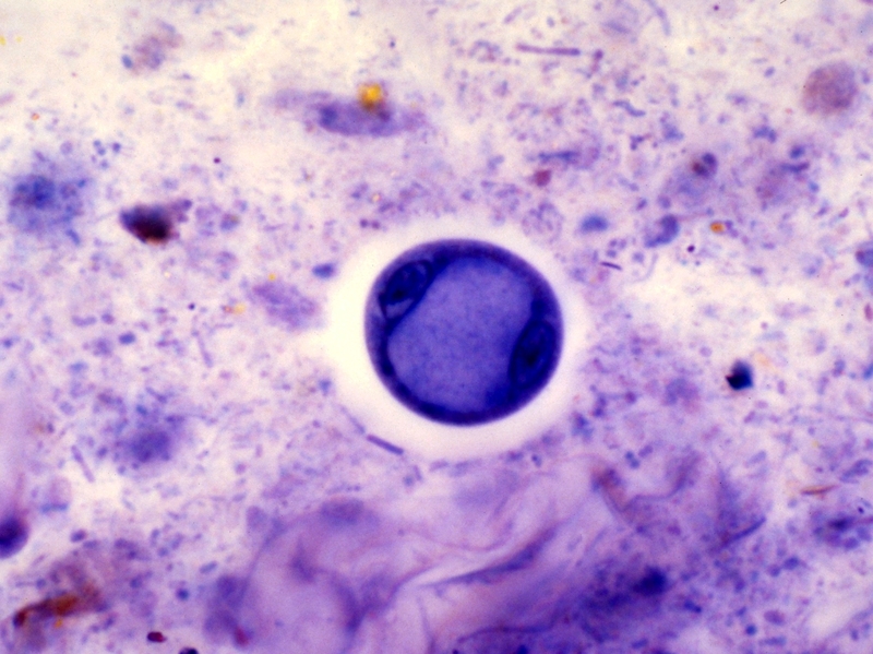 E coli - Low levels detected