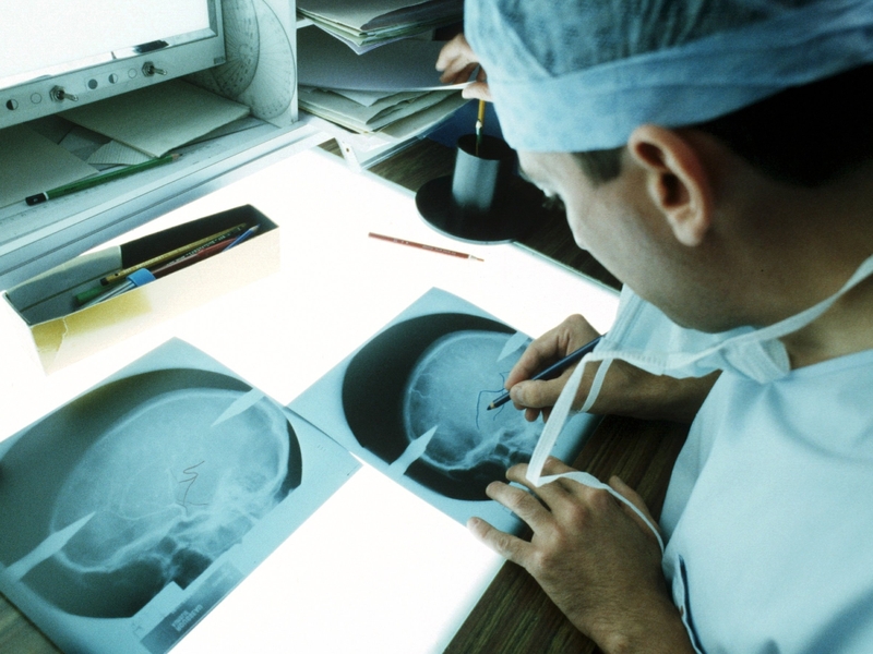 Epilepsy - Fifty million sufferers