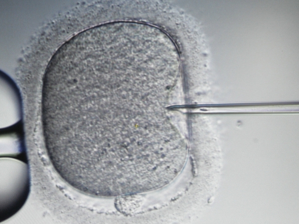 Embryos - Dispute between separated couple