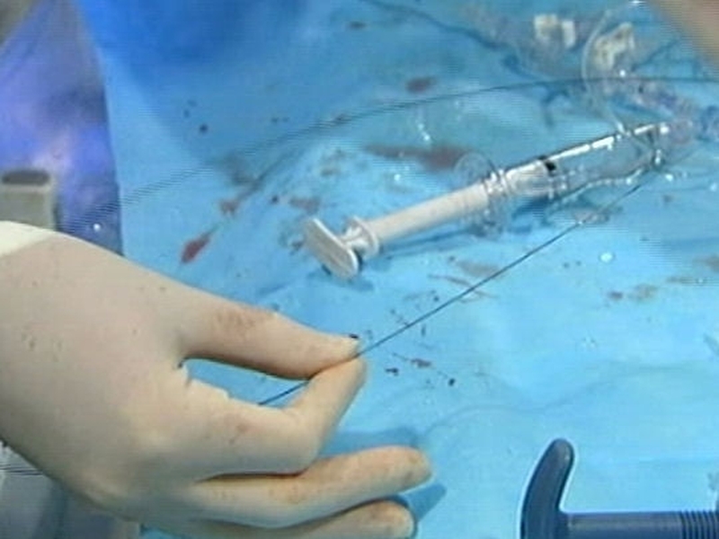 Medical treatment - Recommendations made