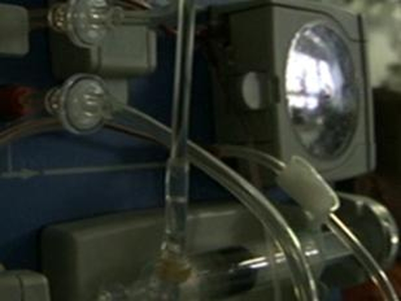Dialysis - Used as treatment for kidney failure