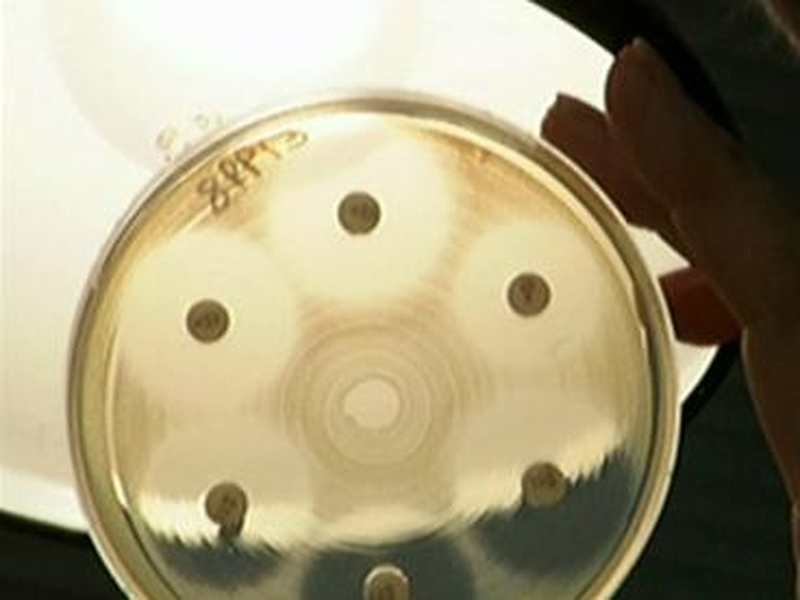 MRSA - 419 cases in 2008