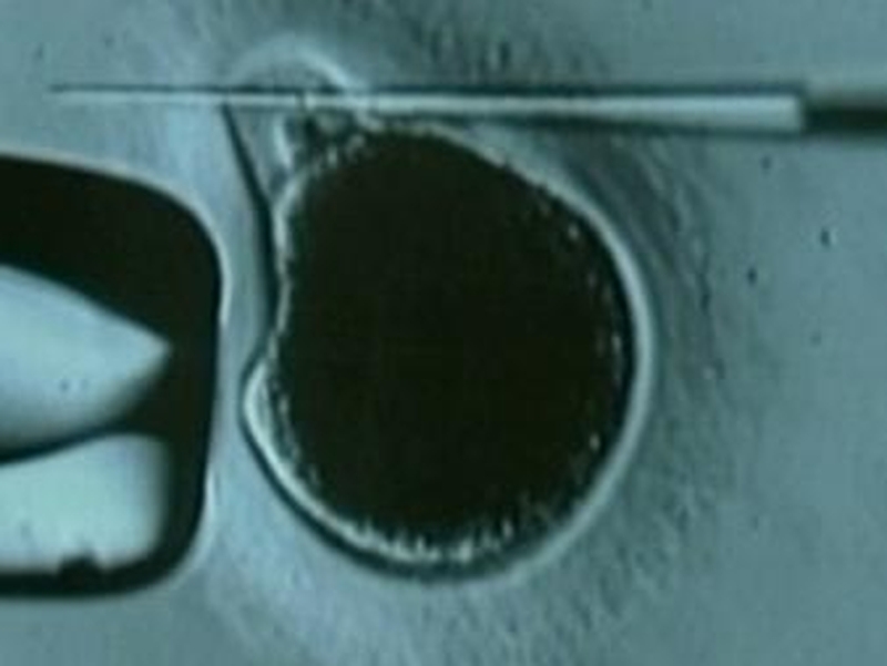 Stem cell research - Backing from UCC chiefs