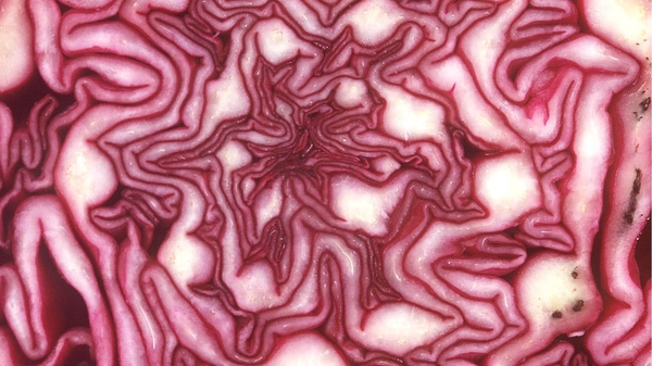 Seared Breast of Wood Pigeon with Smoked Bacon and