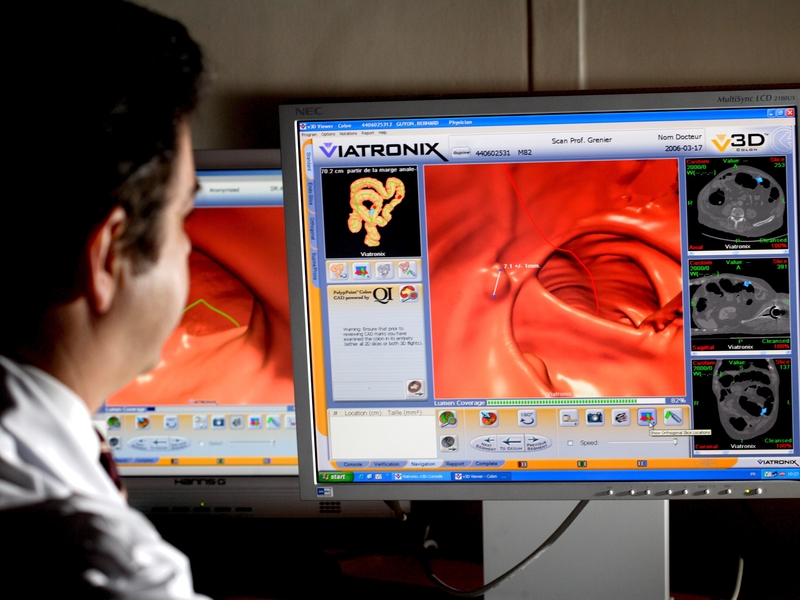 The HSE's targets state that no one should wait more than 13 weeks for a colonoscopy