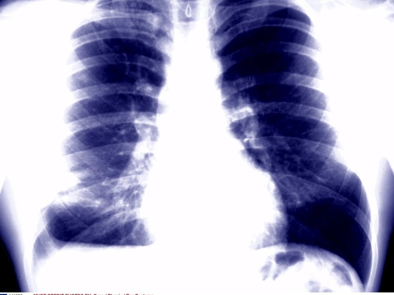 The RCSI Faculty of Radiologists says that the demand for services in Ireland is increasing