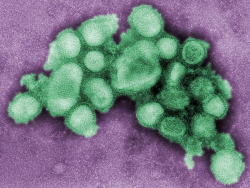 Swine Flu - Death in Scotland