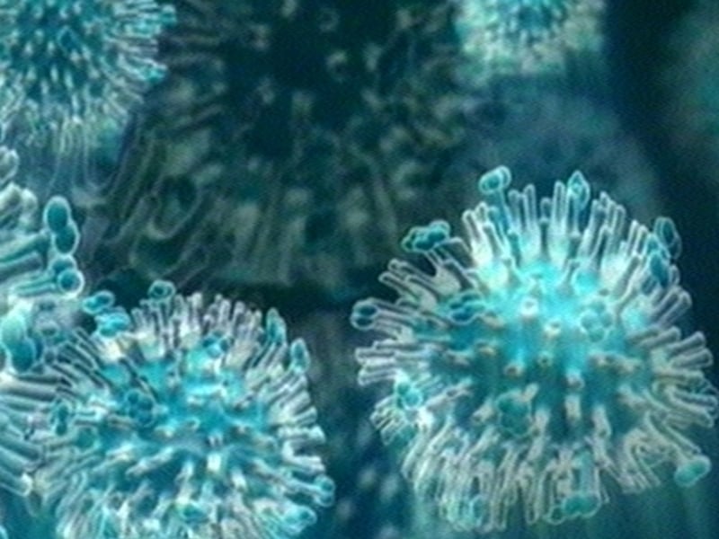 Swine flu - Woman dies in NI