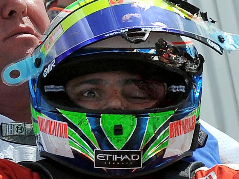 Felipe Massa - Has been out of action since July