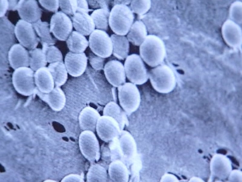 Swine flu - Two more deaths in the Republic