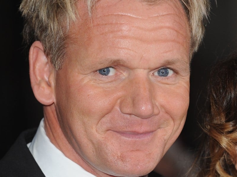 Gordon Ramsay - pictured recently after he had the procedure