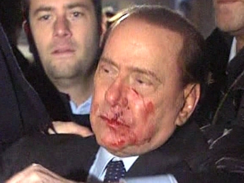 Silvio Berlusconi - Attacked last week