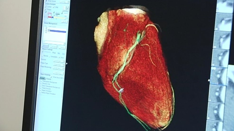 Heart failure - Drug could reduce risk of death