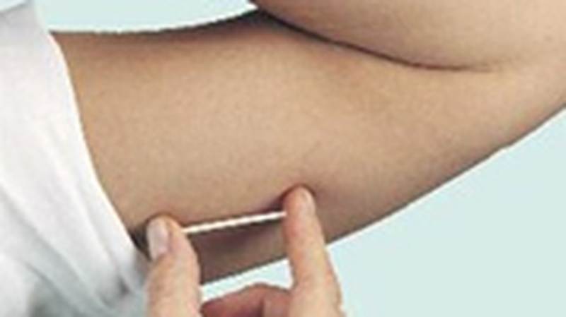 Implanon - Tube inserted into the arm (Pic: www.implanon.co.uk)