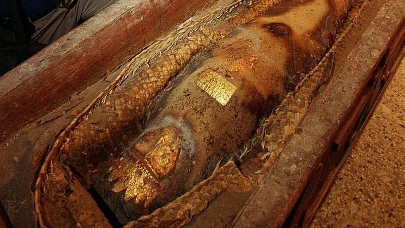 Mummy - Latest finding suggests that the syndrome may be more prevalent than thought