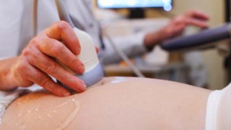 The main purpose of the foetal anomaly scan is to screen for structural foetal abnormalities