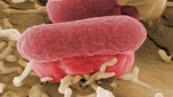 E coli - Can result in full-blown haemolytic uraemic syndrome