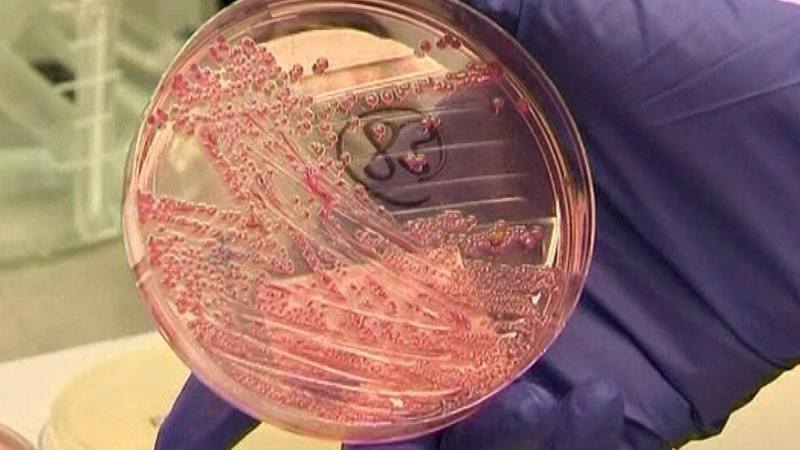 There were 200 cases of VTEC or E coli 026 reported in Ireland in 2010