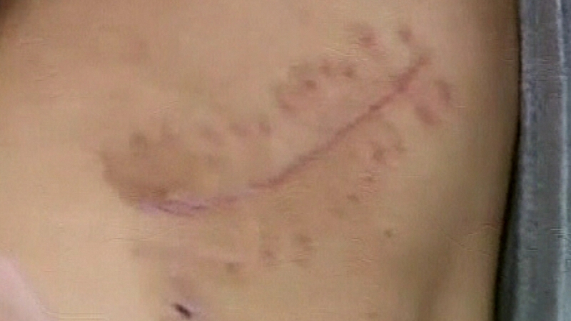 China - Kidneys sell for around $3k