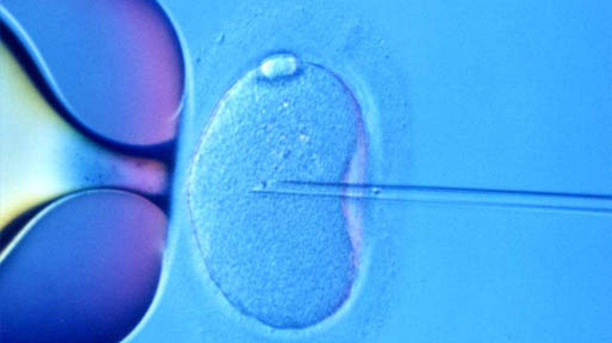 IVF Paul Murphy and Jess Spear