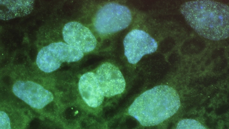 Stem cell hope for end to liver transplants