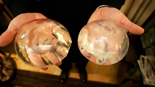 Irish patients with concerns should contact their implanting surgeon