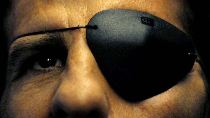 Juan Jose Padilla has undergone surgery to try to regain movement in his face and vision in his eye