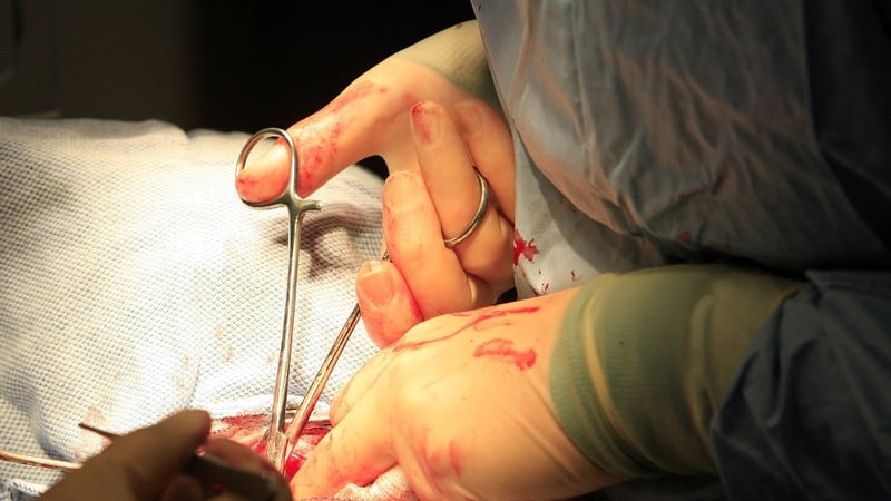 Concerns were raised over the living donor programme in Ireland