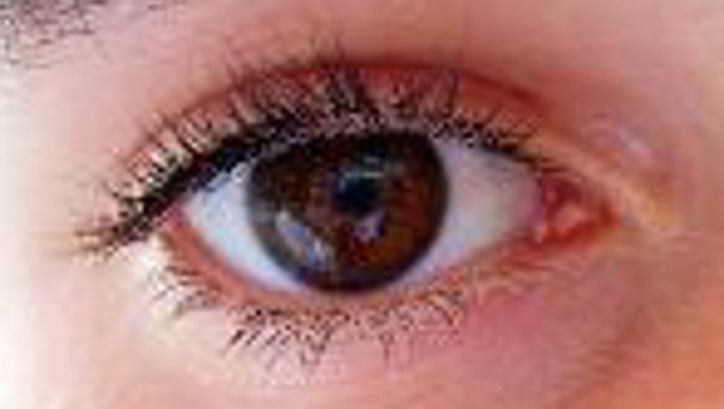 National register to be set up of patients who get involved