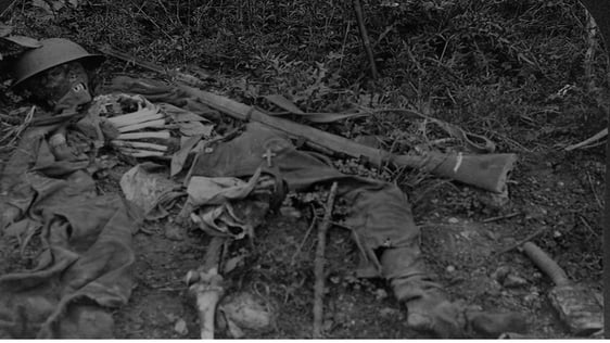 A British Army casualty

Image from World War Through the Stereoscope (Meadville, PA, 1921)