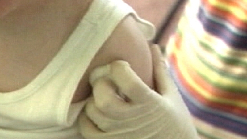 Outbreak of measles in west Cork