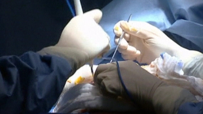 The HSE has requested the review into the benefits of planned surgery