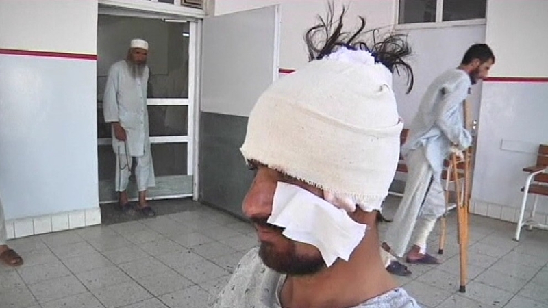 The worst of the injured were taken to hospital in Kabul