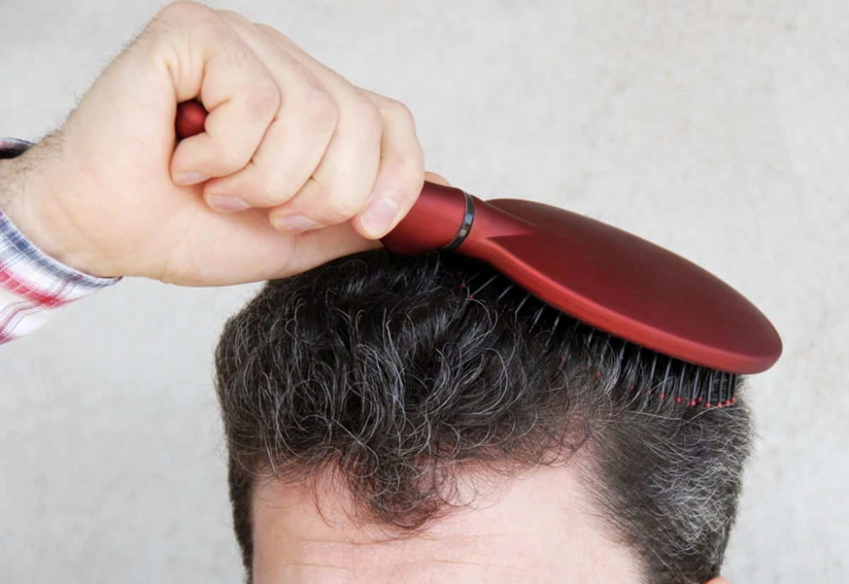 Listener advice - alopecia, hair loss & thinning hair