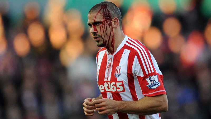 Jonathan Walters leaves the field for treatment on a head cut