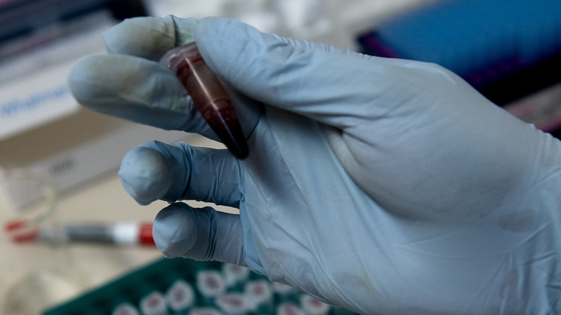 People with haemophilia say they are experiencing problems getting anti-viral treatments